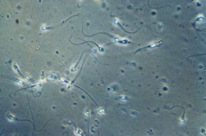Spermiogram: pregled semenske tekočine pri zdravljenju neplodnosti ZC Dravlje
