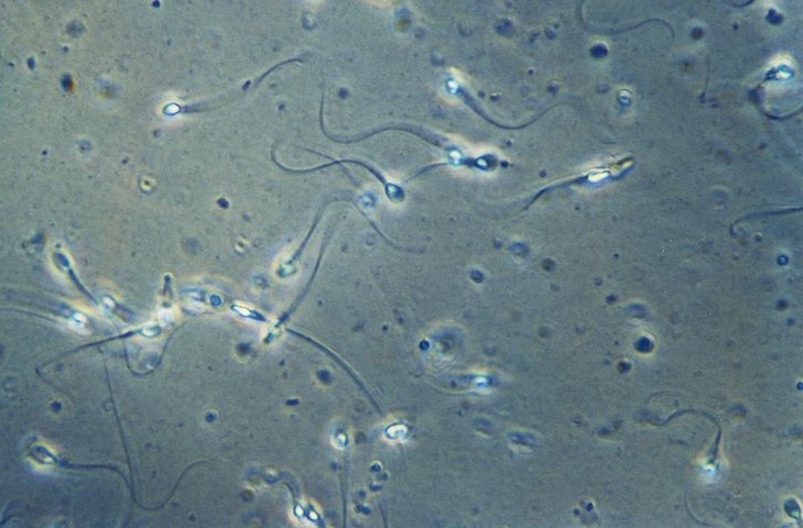 Spermiogram: pregled semenske tekočine pri zdravljenju neplodnosti ZC Dravlje